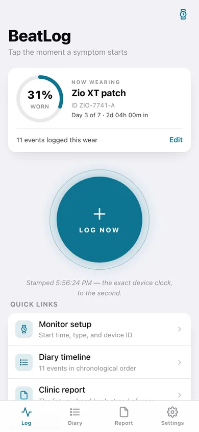 BeatLog web app — screen 1