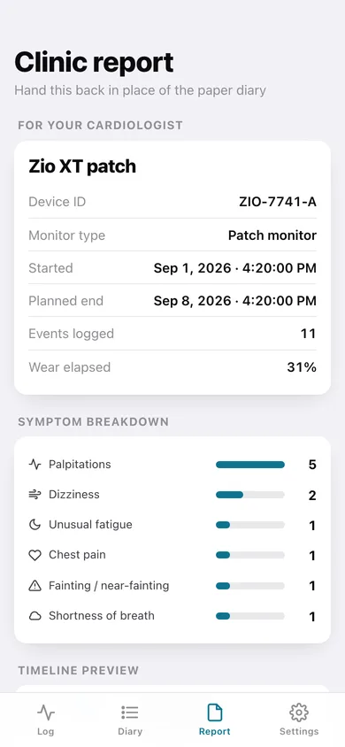 BeatLog web app — screen 3